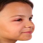 Eye Infection Types, Symptoms & Treatments in Babies