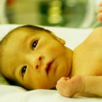 How to Get Rid of Jaundice in Newborns at Home